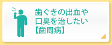 歯ぐきの出血や口臭を治したい【歯周病】